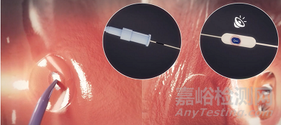 【創(chuàng)新醫(yī)械】首款“零交換+阻抗引導”經(jīng)房間隔通路系統(tǒng)獲批FDA