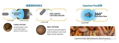 【創(chuàng)新醫(yī)械】CapsoCam UGI:能診斷胰腺癌的膠囊內(nèi)鏡