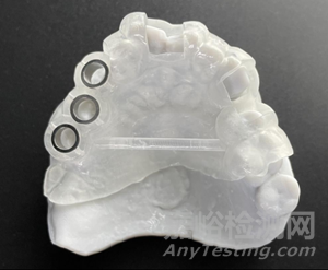 剛剛，牙科種植用導板注冊審查指導原則征求意見