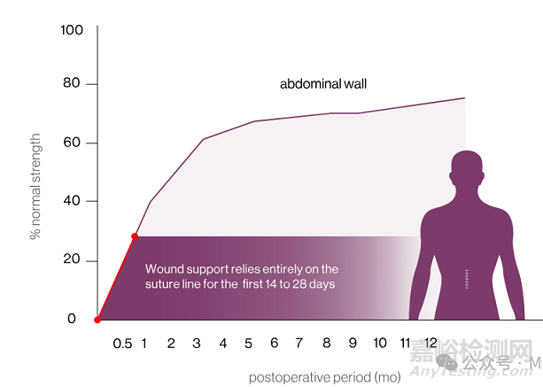 【創(chuàng)新醫(yī)械】Suture-TOOL：革命性腹部縫合器獲批上市，讓縫合標(biāo)準(zhǔn)化
