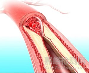 全球首款實(shí)現(xiàn)基于定量指數(shù)的實(shí)時(shí)深層組織灌注監(jiān)測(cè)設(shè)備