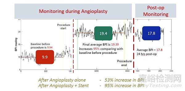 全球首款實(shí)現(xiàn)基于定量指數(shù)的實(shí)時(shí)深層組織灌注監(jiān)測(cè)設(shè)備