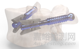 【創(chuàng)新醫(yī)械】可降解鎂合金骨折固定器械獲 FDA“突破性設(shè)備認(rèn)定”