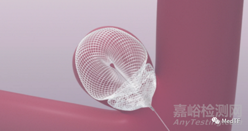 SEAL：水母型的瘤內(nèi)擾流裝置完成IDE臨床研究入組