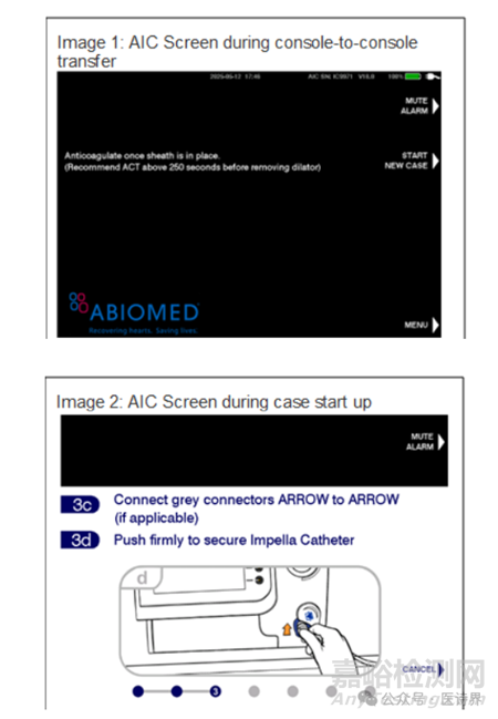 強生一級召回介入心臟泵，已致3起死亡