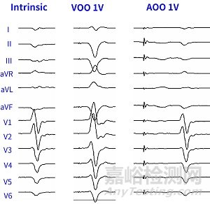 單器械無導線雙腔起搏動物實驗結果驗證其技術可行性