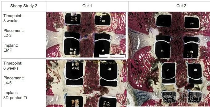 Spark：會(huì)發(fā)電的融合器 | 加速骨生長(zhǎng)