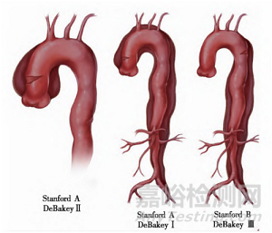 普惠生物創(chuàng)新醫(yī)械分支型主動脈術(shù)中支架系統(tǒng)技術(shù)解析