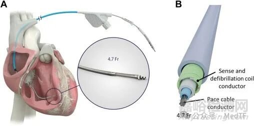 美敦力推出全球最細(xì)除顫導(dǎo)線，直徑僅41.6毫米