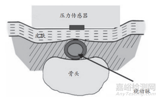 剛剛，自動無創(chuàng)血壓計臨床準確度驗證審評要點征求意見（附全文）