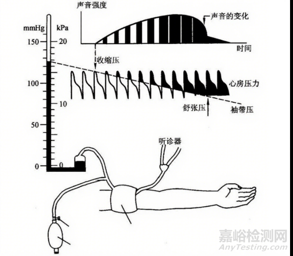 剛剛，自動無創(chuàng)血壓計臨床準確度驗證審評要點征求意見（附全文）
