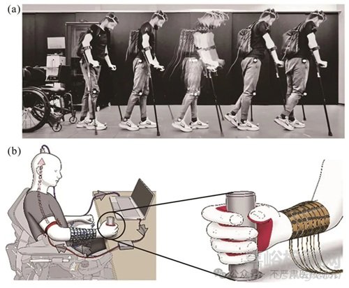 植入式腦機接口系統(tǒng)實現(xiàn)、臨床進展與技術(shù)挑戰(zhàn)