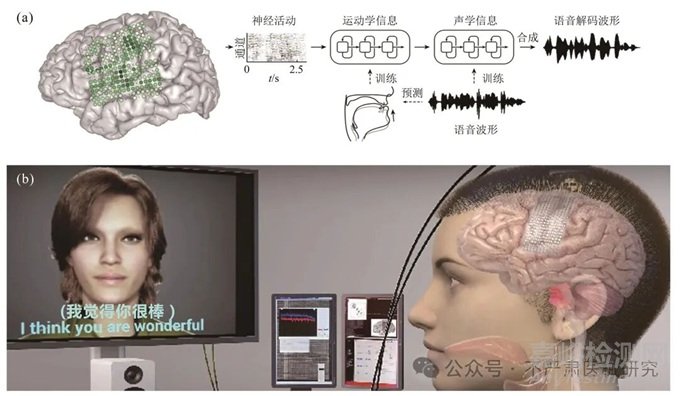 植入式腦機接口系統(tǒng)實現(xiàn)、臨床進展與技術(shù)挑戰(zhàn)