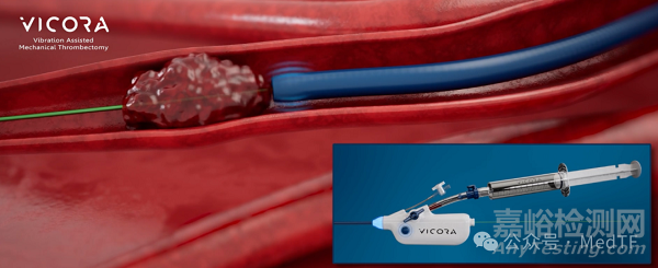【創(chuàng)新醫(yī)械】Vibrato：全球首款集成遠端振動功能的取栓導(dǎo)管