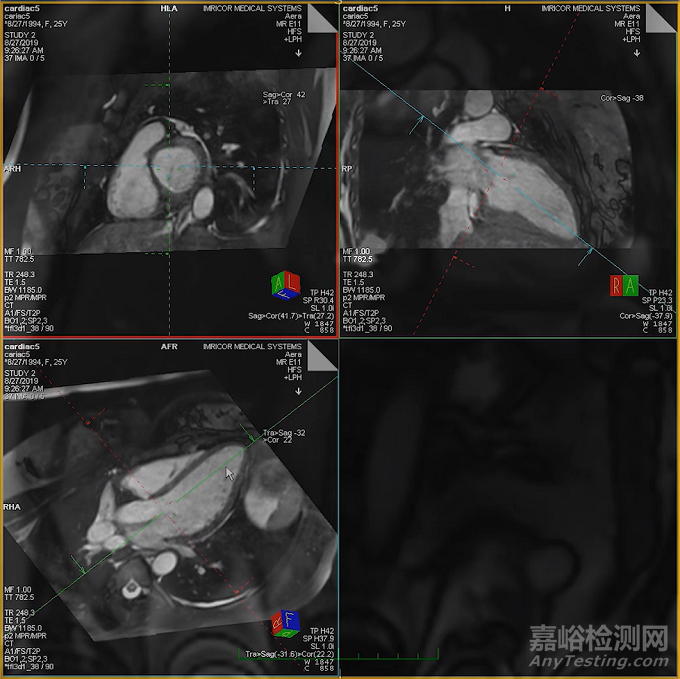 【創(chuàng)新醫(yī)械】全球首款兼容MRI診斷導(dǎo)管獲批FDA