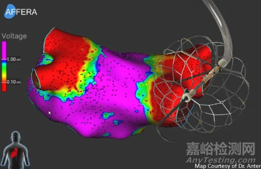【創(chuàng)新醫(yī)械】美敦力全球首創(chuàng)的一體化標(biāo)測(cè)與單次脈沖場(chǎng)消融導(dǎo)管Sphere-360獲批FDA